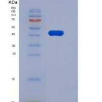 人HtrA2 / Omi重组蛋白His Tag