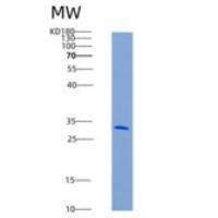 人KIM-1 / TIM1 / HAVCR1重组蛋白