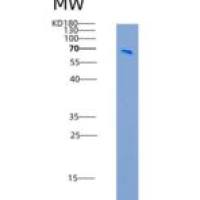 大鼠DDR2 Kinase / CD167b重组蛋白Fc tag