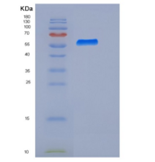 人Biotinidase / Biotinase / BTD