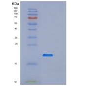 小鼠PILR-alpha / PILRA重组蛋白His tag