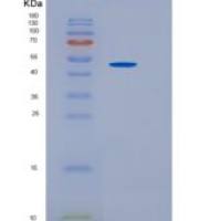 人IFNAR2 / IFNABR重组蛋白Fc tag