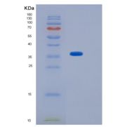 小鼠SFTPD / SP-D / SFTP4重组蛋白His tag