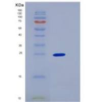 大鼠JAM-2 / JAM-B重组蛋白His tag
