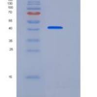 小鼠Cystatin 7 / CST7重组蛋白Fc tag