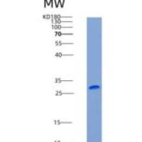 人TROP2 / TACSTD2重组蛋白His tag