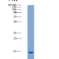 人CCDC47重组蛋白His tag