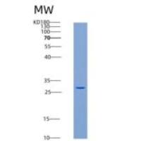 人GSTM2 / GST4重组蛋白His tag