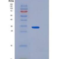 小鼠CD64 / FCGR1重组蛋白His & AVI tag, Biotinylated