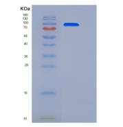 人LIFR / CD118重组蛋白His tag