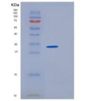 小鼠EpCAM / TROP-1 / TACSTD1重组蛋白His tag