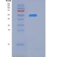 小鼠CD226 / DNAM-1重组蛋白His & Fc tag