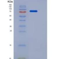 小鼠CSF1R / MCSF Receptor / CD115重组蛋白His & Fc tag