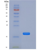 小鼠TNFRSF19 / TROY重组蛋白His tag