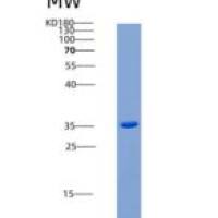 小鼠CD14分子(CD14)重组蛋白His tag