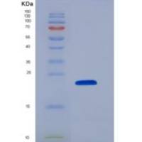 小鼠Fc γ RII/CD32b/FCGR2重组蛋白C-6His