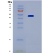 小鼠CD200受体1(CD200R1)重组蛋白His & F