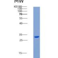 人KIM-1 / TIM1 / HACVR1重组蛋白His tag