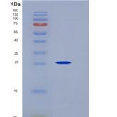 小鼠激肽释放酶7(KLK7)重组蛋白His Tag