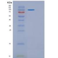 小鼠接触蛋白1(CNTN1)重组蛋白His tag