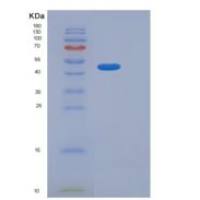 人吲哚胺2,3-双加氧酶2(IDO2)重组蛋白His tag