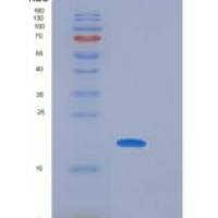 小鼠PGLYRP1 / PGRP-S重组蛋白His tag