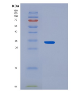 小鼠CD64 / FCGR1重组蛋白His & AVI ta