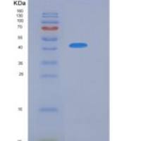 小鼠CD4分子(CD4)重组蛋白His tag