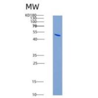 人髓细胞触发受体1(TREM1)重组蛋白His & Fc tag