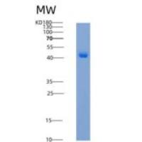 大鼠羧肽酶A2(CPA2)重组蛋白His Tag