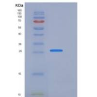 大鼠Coagulation Factor III / Tissue Factor / CD142重组蛋白His tag