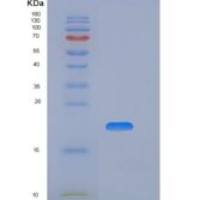 人Ⅱ类主要组织相容性复合体不变链(CD74)重组蛋白His Tag