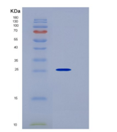 小鼠激肽释放酶7(KLK7)重组蛋白His Tag