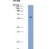 小鼠LIMP-2 / SCARB2 / CD36L2重组蛋白His tag