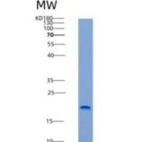 人GM2神经节苷脂激活因子(GM2A)重组蛋白His Tag