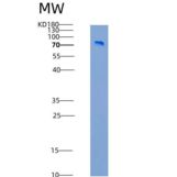 人SLITRK1重组蛋白His & Fc tag