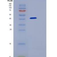 人胃蛋白酶原C(PGC)重组蛋白His tag