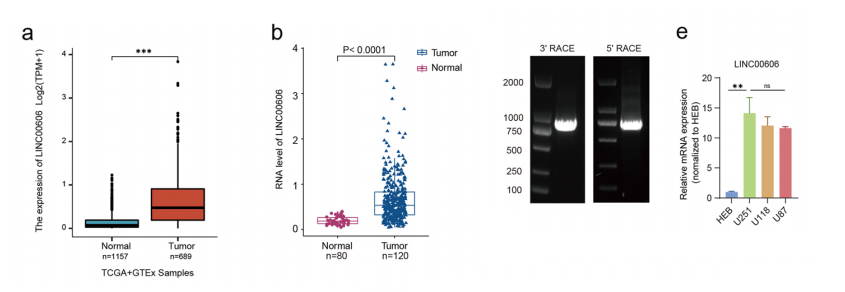 分子探针与表观遗传学研究好文分享：LINC00606通过海绵miR-486-3p和与ATP11B的相互作用促进胶质母细胞瘤的进展