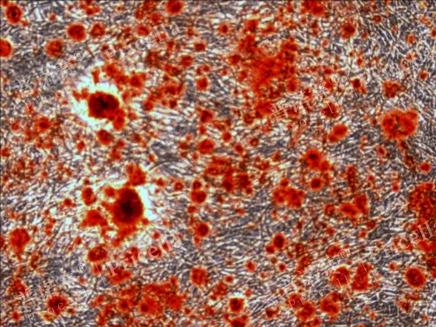 MC3T3-E1 Subclone 14诱导第15天，茜素红染色