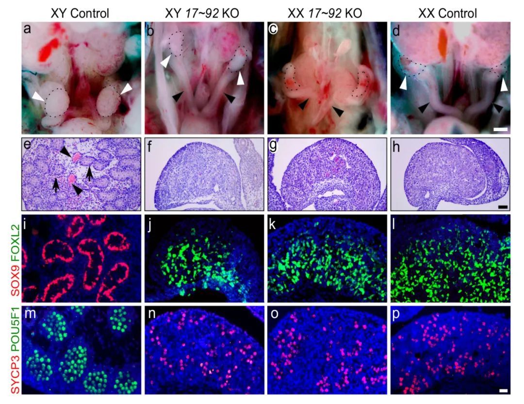 miRNA研究进展盘点丨20240516期