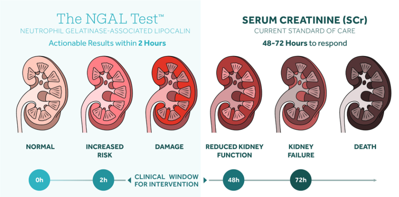 The NGAL Test™ Control Kit/ NG