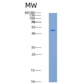 人细胞周期素A1(CCNA1)重组蛋白His tag