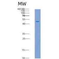 人细胞周期素A1(CCNA1)重组蛋白His tag