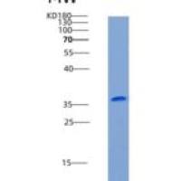 大鼠CD112 / Nectin-2 / PVRL2重组蛋白His tag