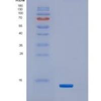 大鼠CD83分子(CD83)重组蛋白His tag