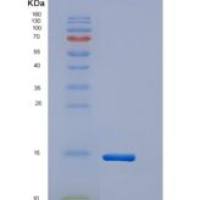 人TNFRSF13B / TACI / CD267重组蛋白His tag