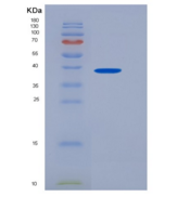 大鼠SIRP alpha / CD172a重组蛋白His t