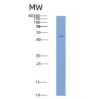 人TIM-3 / HAVCR2重组蛋白His & Fc tag