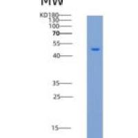 小鼠OX40重组蛋白Fc Tag