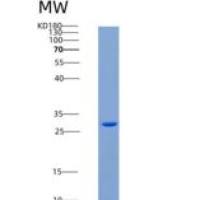 人TNFR2 / CD120b / TNFRSF1B重组蛋白His tag